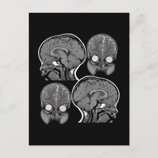 BRAINS! (MRI) BRIEFKAART (Voorkant)