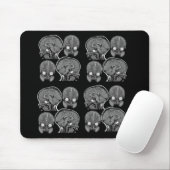 BRAINS! (MRI) MUISMAT (Met muis)