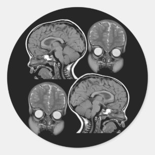 BRAINS! (MRI) RONDE STICKER