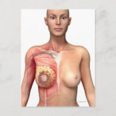 Breedkanker Briefkaart (Voorkant)