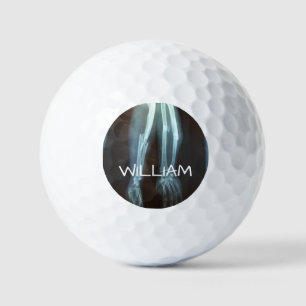 Breuken Radius en Ulna Xray "Pauze tijd" Golfballen