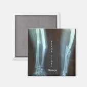 Breuken Radius en Ulna Xray "Pauze tijd" Magneet (Voorkant / Achterkant)