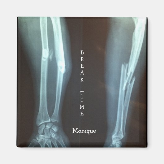 Breuken Radius en Ulna Xray "Pauze tijd" Magneet (Voorkant)