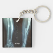 Breuken Radius en Ulna Xray "Pauze tijd" Sleutelhanger (Achterkant)