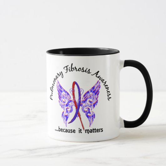 Butterfly 6.1 Pulmonaire fibrose Mok (Rechts)