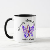 Butterfly 6.1 Pulmonaire fibrose Mok (Links)