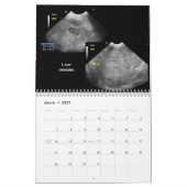 Calendrier des images ultrasoniques (Mar 2027)