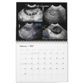 Calendrier des images ultrasoniques (Feb 2027)