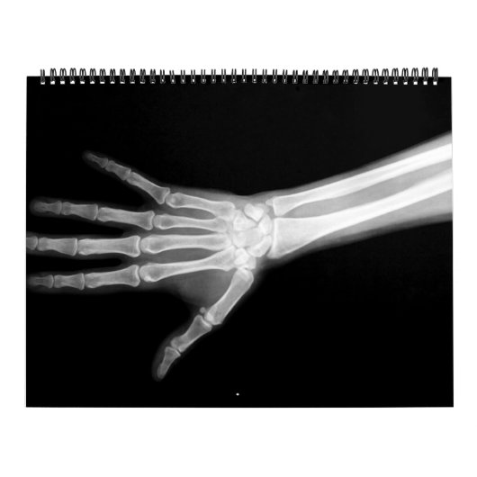 Calendrier Squelette X-Ray noir & blanc (Protection)