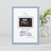 Camion photo Ultrasound Merci Blue Baby Viewpoint (Debout devant)