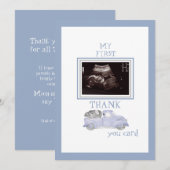 Camion photo Ultrasound Merci Blue Baby Viewpoint (Devant / Derrière)