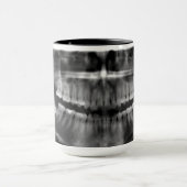 Caneca Radiografia Panoramica Mok (Midden)