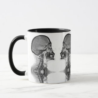 Caneca Radiologica Mok