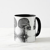 Caneca Radiologica Mok (Voorkant rechts)