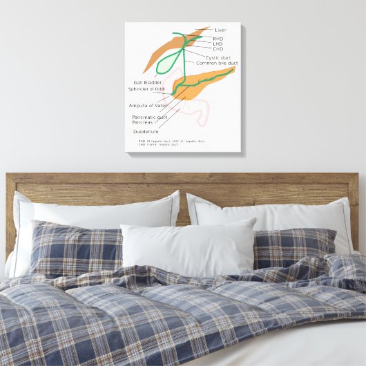 Canvas Galblaasdiagram (Insitu (Slaapkamer))