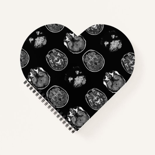 Carnet Analyse IRM du cerveau (Devant)