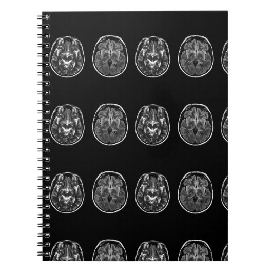 Carnet Analyse Mri du cerveau (Devant)