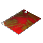 Carnet Bactéries de Penumonia (Côté gauche)