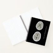 Carnet CT Scan_CTFOD_ Voici à quoi ressemble la dépressio (Intérieur)