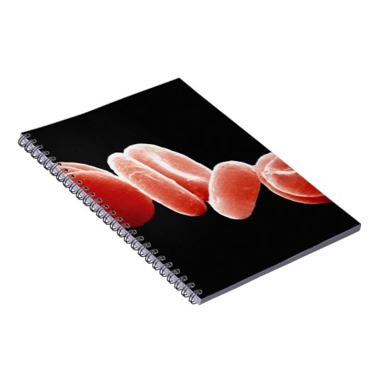 Carnet Globules rouges (Côté Droit)