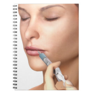 Carnet Injections Botox