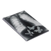 Carnet Rayon X des papillons dans l'estomac (Côté Droit)