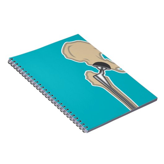 Carnet Remplacement d'articulation de la hanche (Côté Droit)