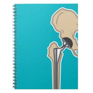Carnet Remplacement d'articulation de la hanche