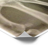 Carpals Xray Poster (Hoek)