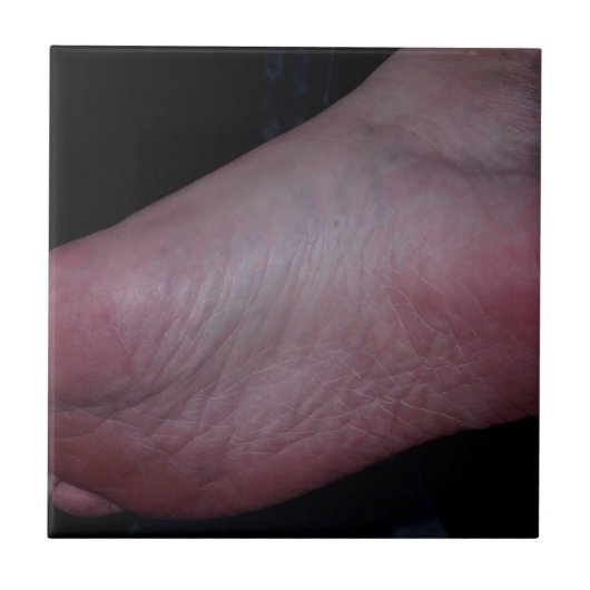 CARREAU DOMME DE PIED (Devant)