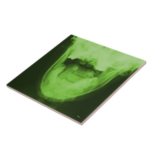 Carreau Émission X 3 - Vert radioactif (Côté)