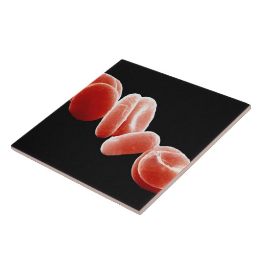 Carreau Globules rouges (Côté)