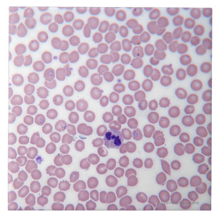 Carreau Globules sanguins malariques
