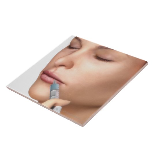 Carreau Injections de botox (Côté)