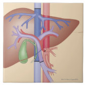 Carreau Procédure de greffe de foie (Devant)