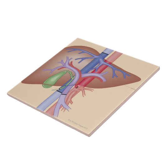 Carreau Procédure de greffe de foie (Côté)