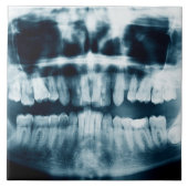 Carreau Rayon X des dents (Devant)
