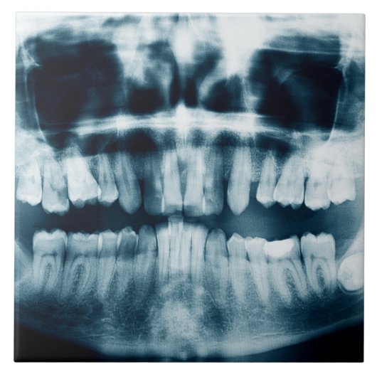 Carreau Rayon X des dents (Devant)