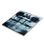 Carreau Rayon X des dents (Côté)