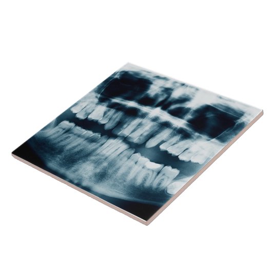 Carreau Rayon X des dents (Côté)