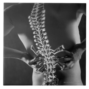 Carreau Vue de corde spinale