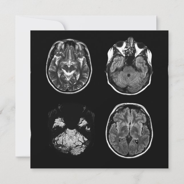 Carte Analyse IRM du cerveau (Devant)