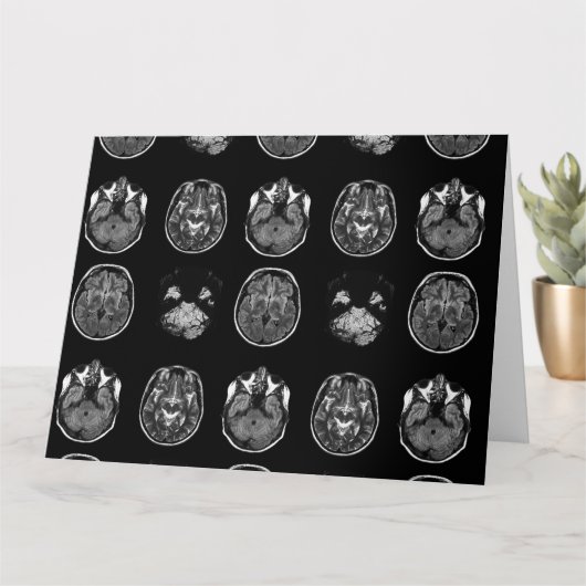 Carte Analyse IRM du cerveau (Petite plante)