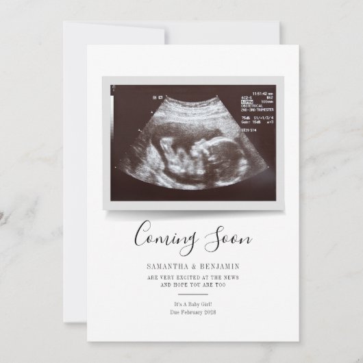 Carte Annonce de grossesse Script Sonogram à venir (Devant)