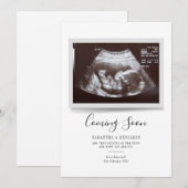 Carte Annonce de grossesse Script Sonogram à venir (Devant / Derrière)