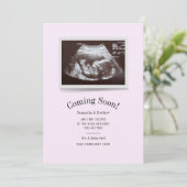 Carte Bientôt Ultrasound Photo Annonce de grossesse (Debout devant)