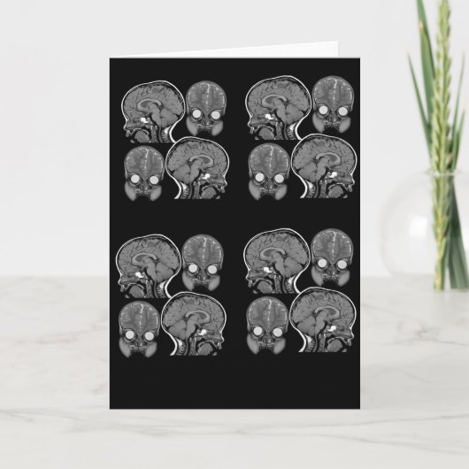 CARTE CERVEAUX ! (IRM) (Devant)