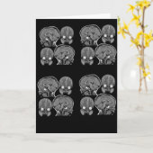 CARTE CERVEAUX ! (IRM) (Fleur jaune)