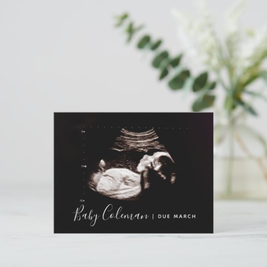 Carte de déclaration de grossesse Échographie (Debout devant)