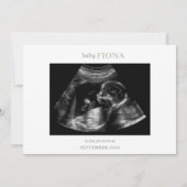 Carte de notification de photo d'échographie bébé  (Dos)
